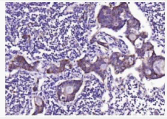 ADM2 中介素抗体
