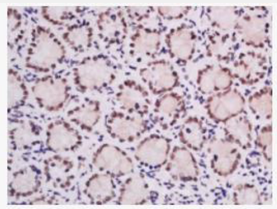 Ubiquitously expressed transcript 广泛表达转录蛋白UXT抗体