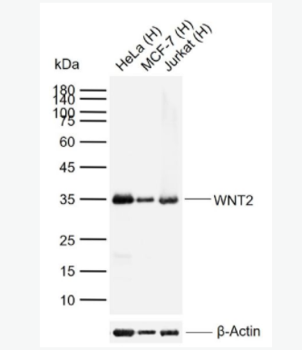 WNT2 信号通路Wnt2抗体
