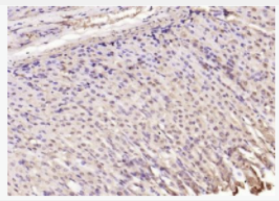 SQSTM1/P62 泛素结合蛋白P62抗体