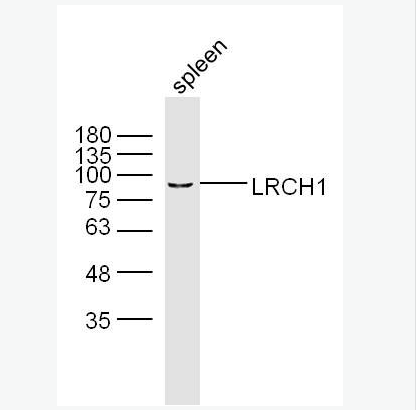 LRCH1 富含亮氨酸重复家庭蛋白1抗体