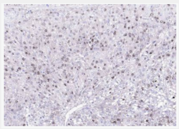 Arginase 1  精氨酸酶1抗体