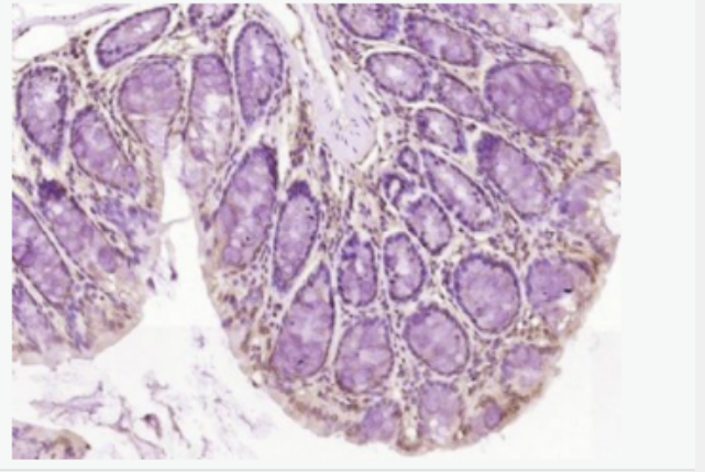 PCYT1A 磷酸乙醇胺转移酶A抗体