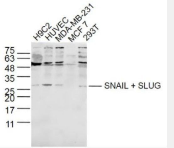 SNAIL + SLUG 锌指转录因子Slug+SNAIL抗体