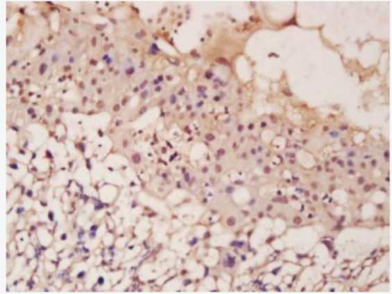 ASCL2 ASCL2蛋白抗体