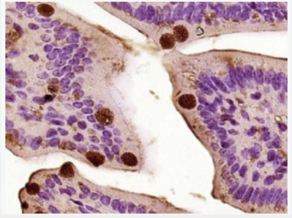 CCL26 趋化因子26/嗜酸粒细胞趋化蛋白3抗体