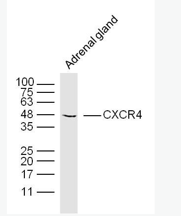 CXCR4 细胞表面趋化因子受体4抗体