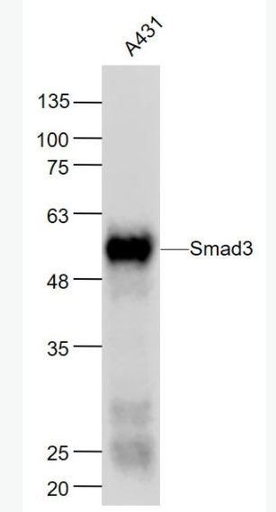 Smad3 细胞信号转导分子SMAD3单克隆抗体