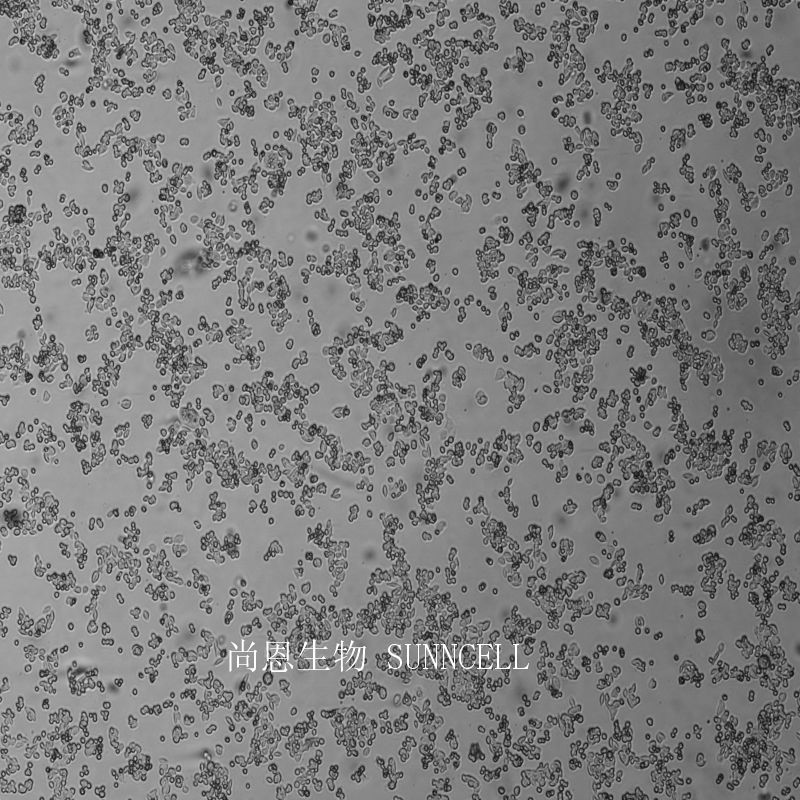 人盲肠腺癌细胞（未分化）