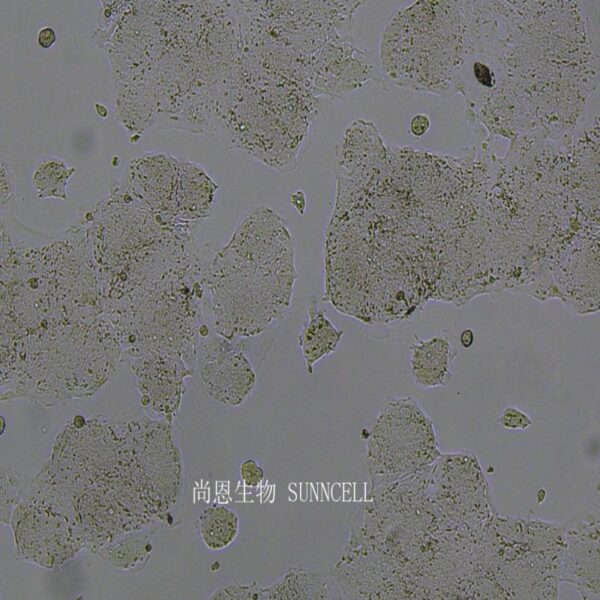 人结肠腺癌肺转移细胞