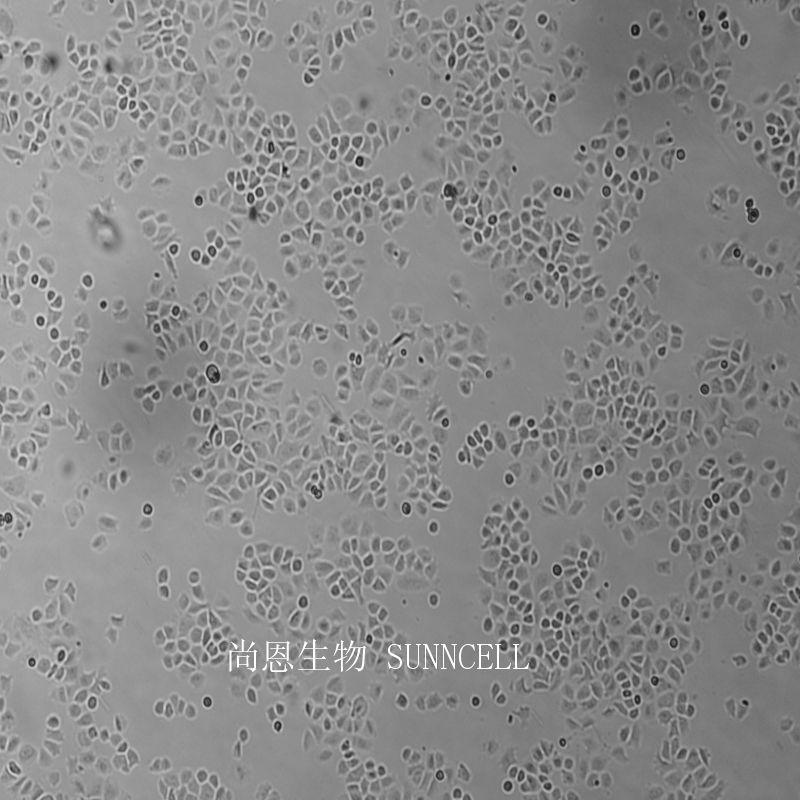 人肾上腺皮质小细胞癌细胞