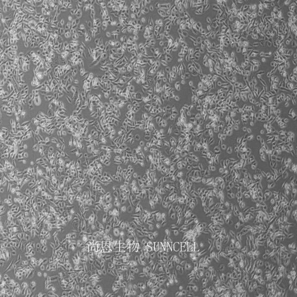 RH30人横纹肌肉瘤细胞