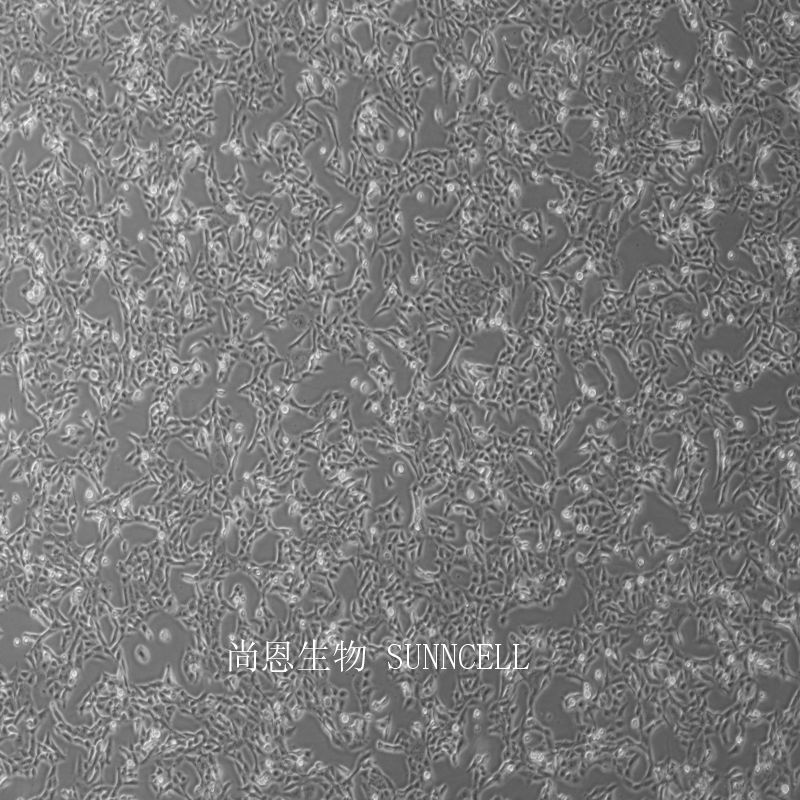 HTR8-Svneo人绒毛膜滋养层细胞