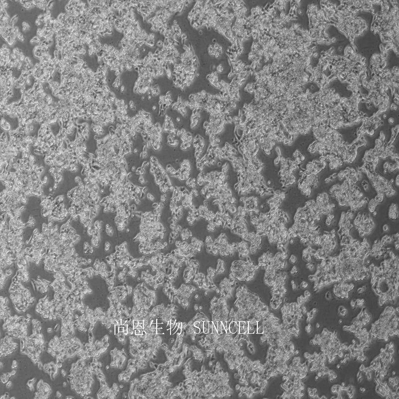 RL95-2人子宫内膜癌细胞