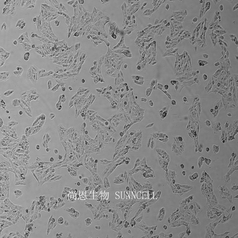 人肺鳞癌细胞