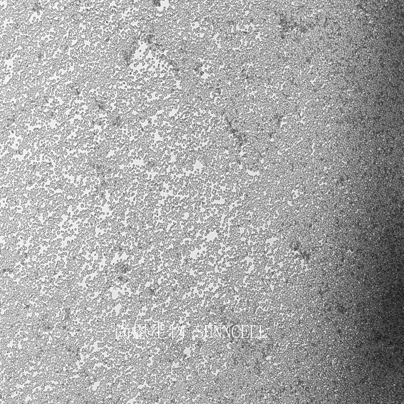 人急性淋巴细胞白血病细胞