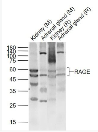 RAGE 晚期糖基化终末产物特异性受体抗体