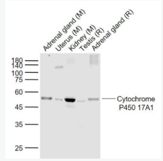  Cytochrome P450 17A1细胞色素P450 17A1重组兔单克隆抗体