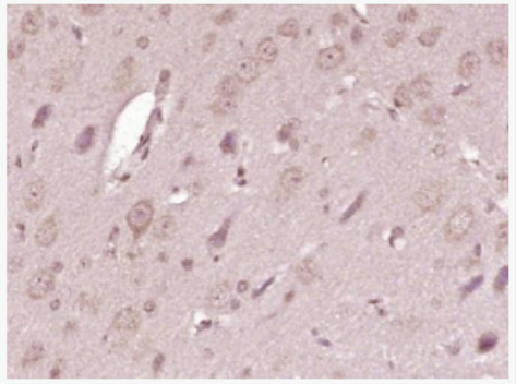 ATP7A 铜转运蛋白质α链抗体