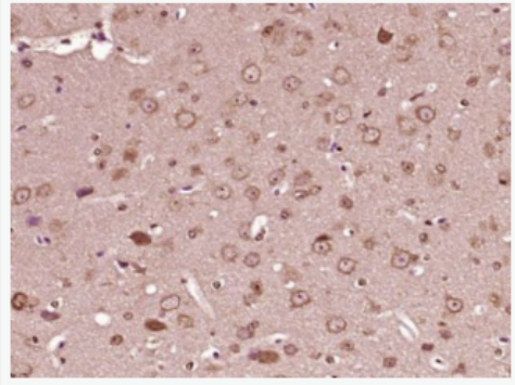 Collagen X Ⅹ型胶原抗体