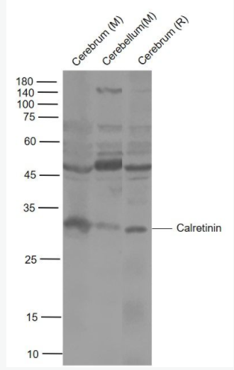 Calretinin 钙结合蛋白抗体