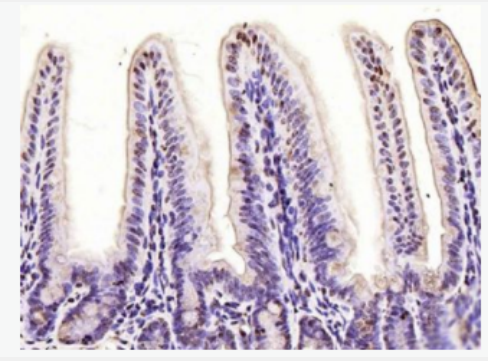 Dnmt3b DNA甲基转移酶-3β抗体