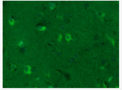 GAP43 神经生长相关蛋白43抗体