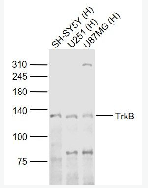 TrkB 酪氨酸激酶B抗体