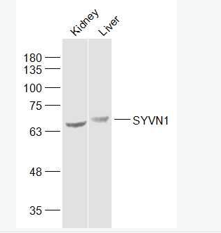 SYVN1 滑膜细胞凋亡抑制物1抗体