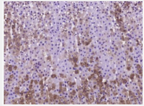 Neuropeptide Y 神经肽Y抗体