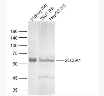 family  钠-糖共转运载体1抗体