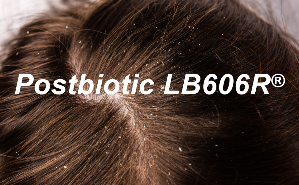 马拉色菌克星乳酸菌发酵溶胞产物