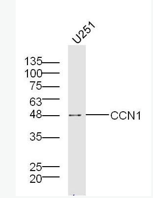 CCN1 富半胱氨酸肝素结合蛋白61抗体