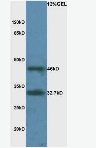 RPSA 层粘连蛋白受体1抗体