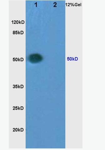 CYP3A4 细胞色素P450 3A4抗体