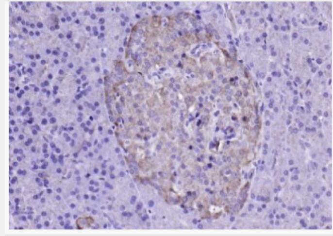 LDHA 乳酸脱氢酶抗体