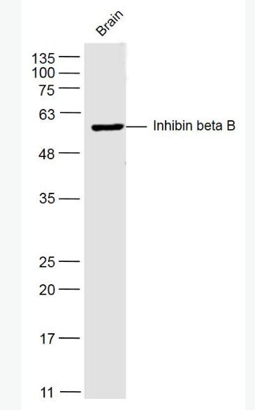 Inhibin beta B 抑制素βB/Inhibin β B抗体