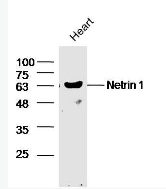  Netrin 1 轴突导向因子1抗体