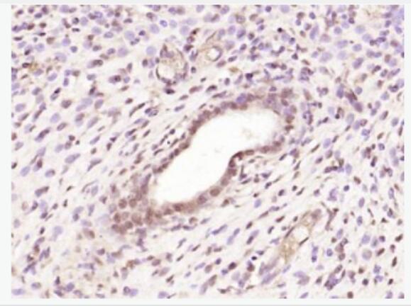 Estrogen Receptor alpha 雌激素受体α抗体