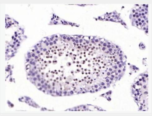 H2AX 组蛋白H2AX抗体
