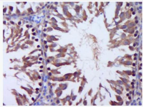 Talin 踝蛋白抗体