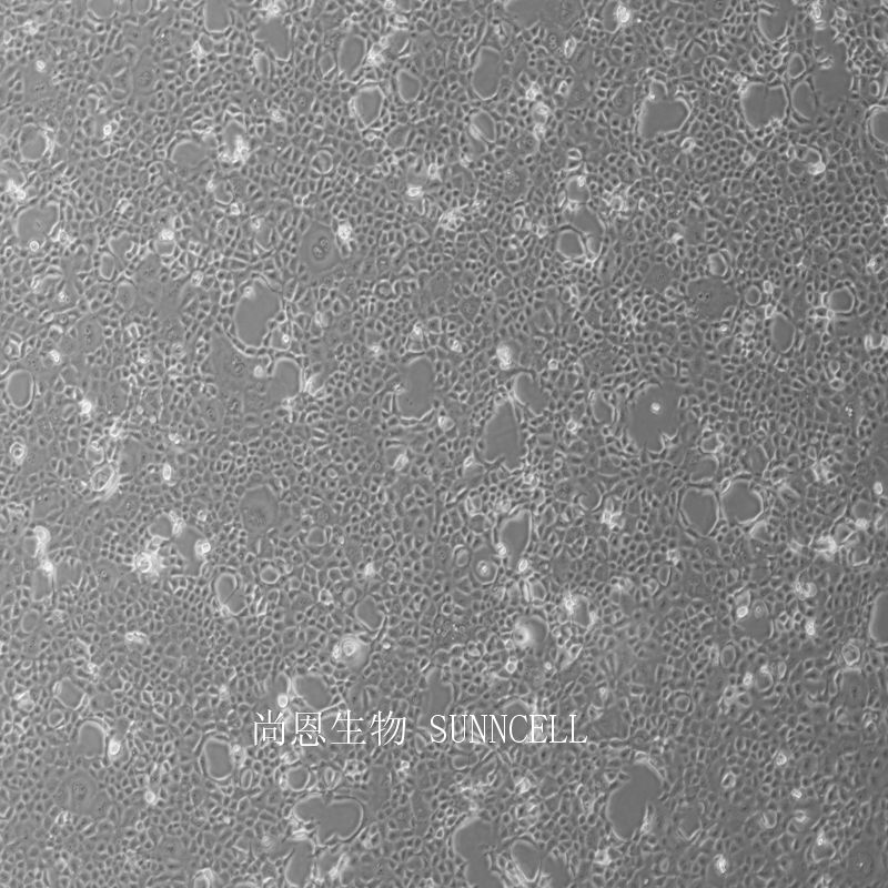 小鼠胚胎肝细胞