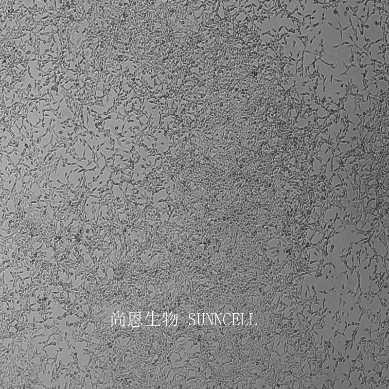 B82小鼠肿瘤细胞系