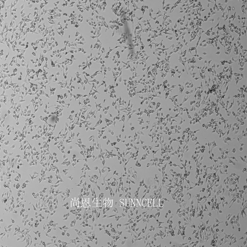 B16-F1小鼠黑色素瘤细胞