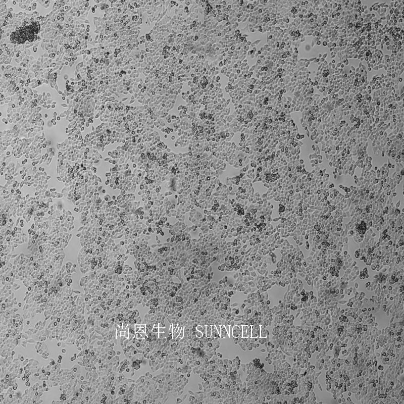 AN3CA人子宫内膜腺癌细胞