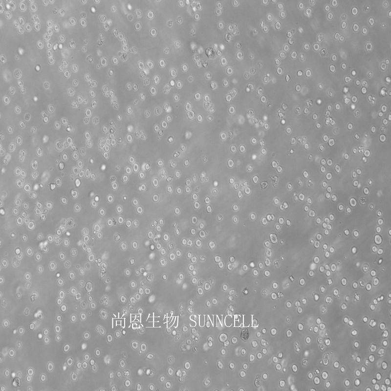 AE-2小鼠杂交瘤细胞（抗AChE）