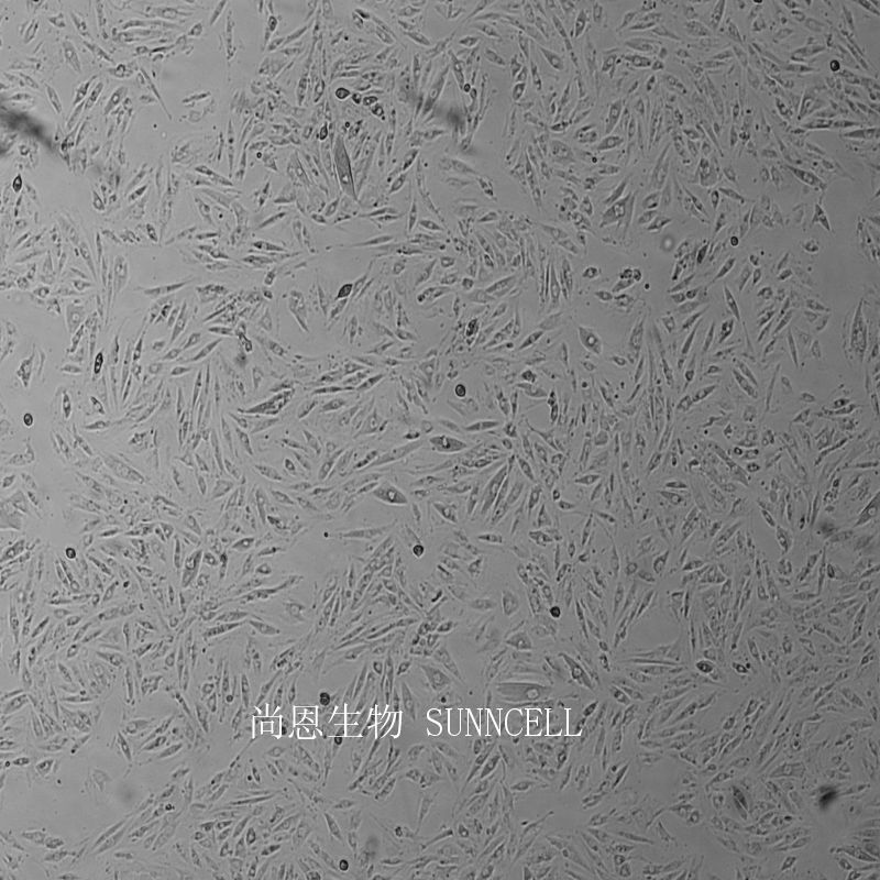 大鼠胸大动脉平滑肌细胞