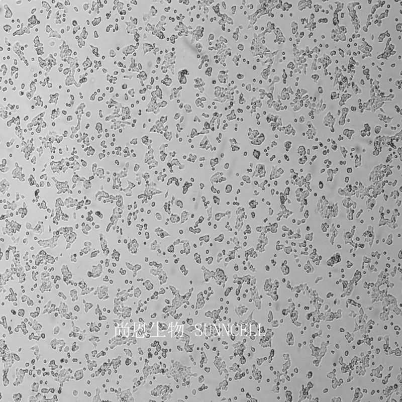 人横纹肌肉瘤细胞