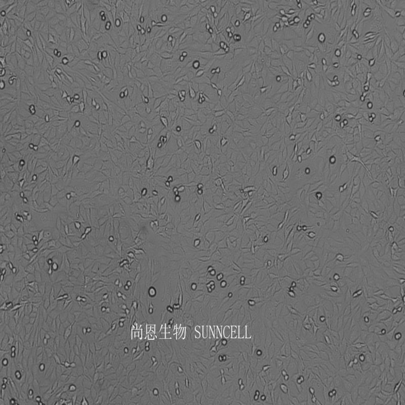大鼠胶质肉瘤细胞