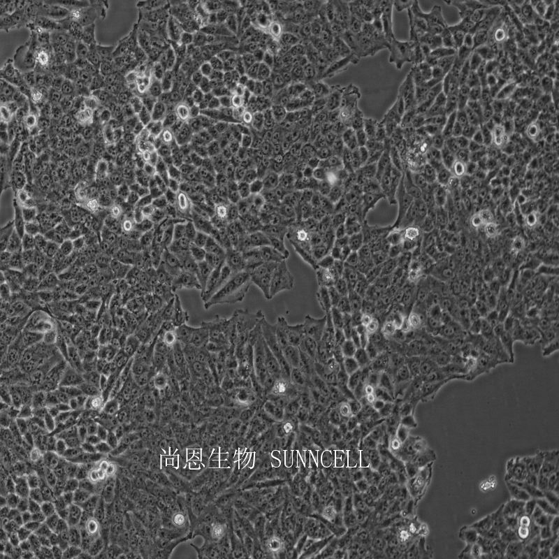 人涎腺腺样囊性癌细胞